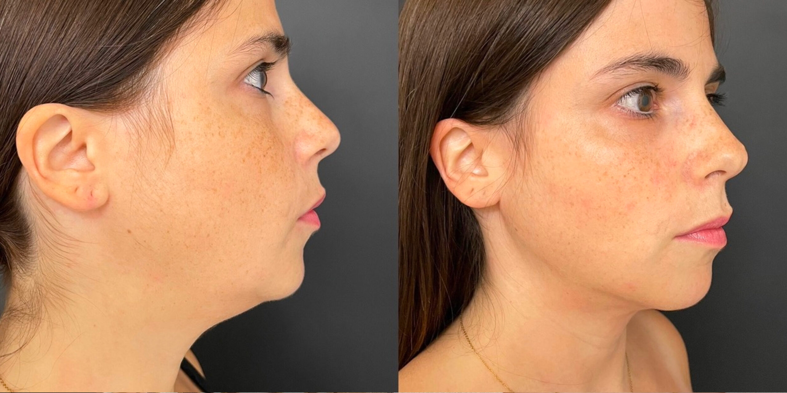 Clinique Capital Care - plastic surgery
