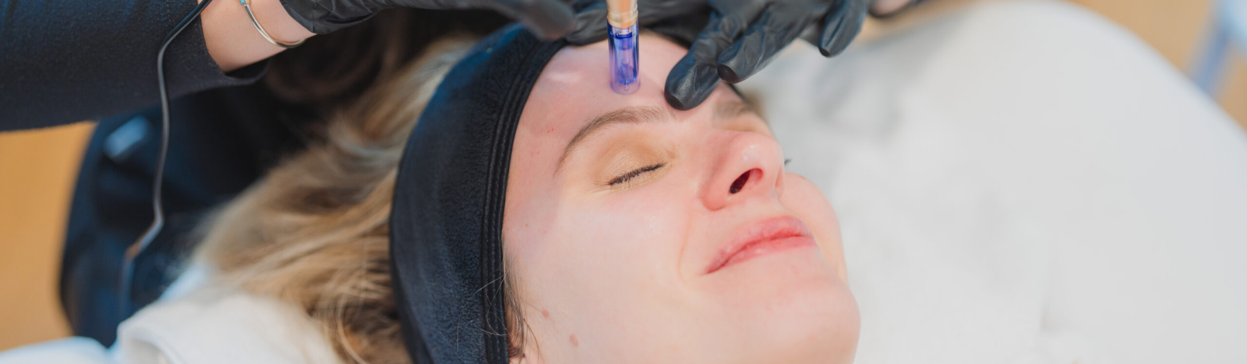 Capital Care Microneedling Bandeau Principal